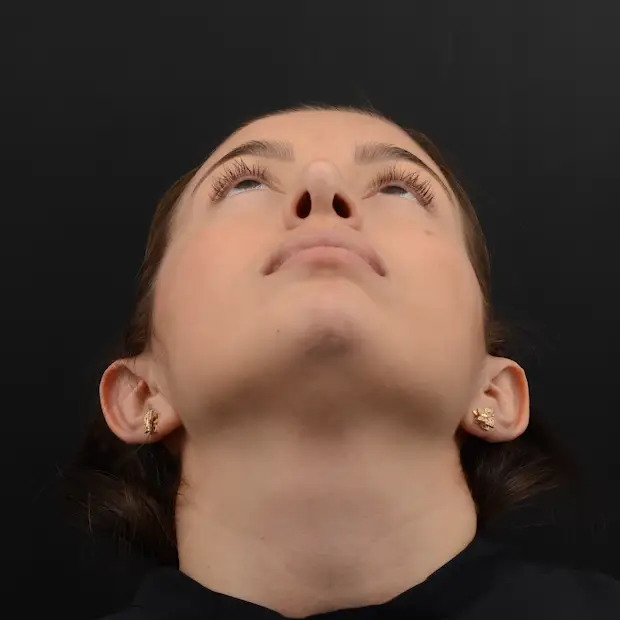 Después