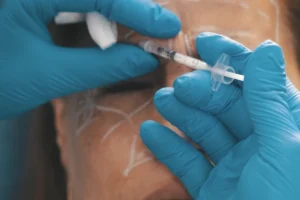 Ácido hialurónico inyectable: ventajas | Dr. Nicolás Heredia