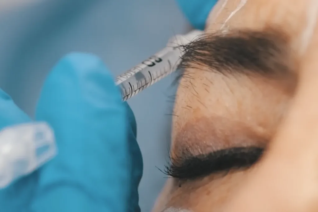 Qué es el ácido hialurónico: beneficios | Dr. Nicolás Heredia