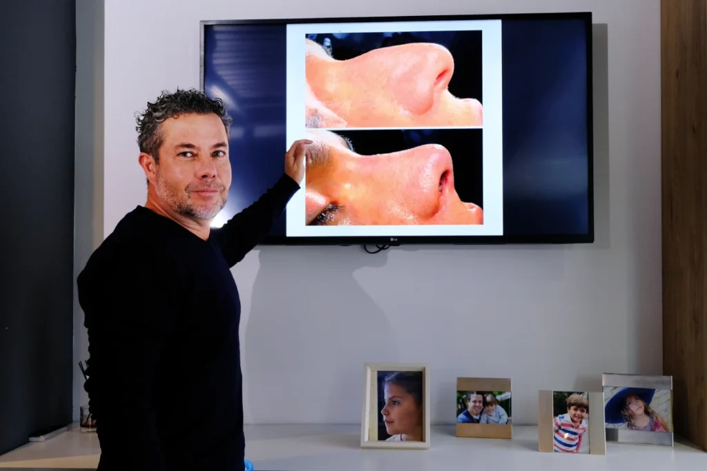 Septoplastia: técnica para respirar mejor | Dr. Nicolás Heredia