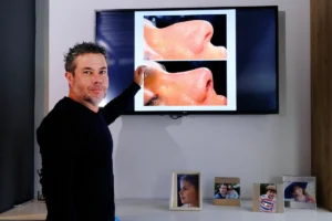 Septoplastia: técnica para respirar mejor | Dr. Nicolás Heredia