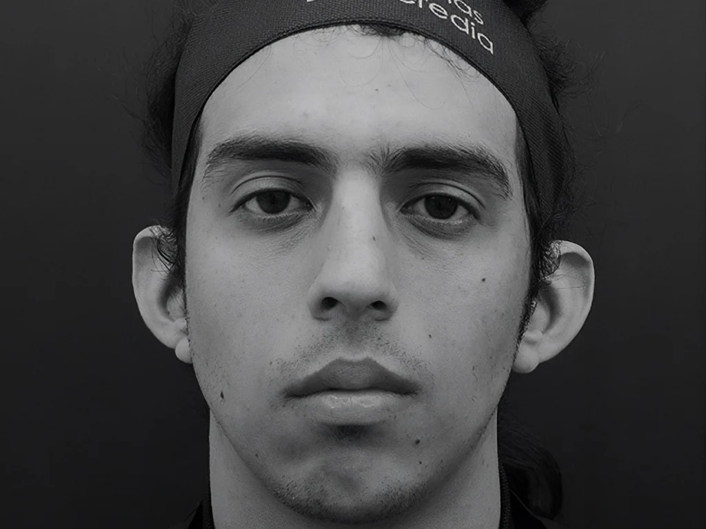 Sin rinoplastia hombres nariz ancha