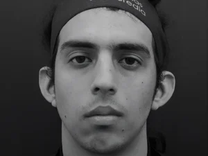 Sin rinoplastia hombres nariz ancha